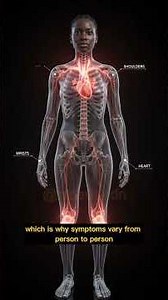 What Are Connective Tissue Disorders? The Hidden Cause of Chronic Pain