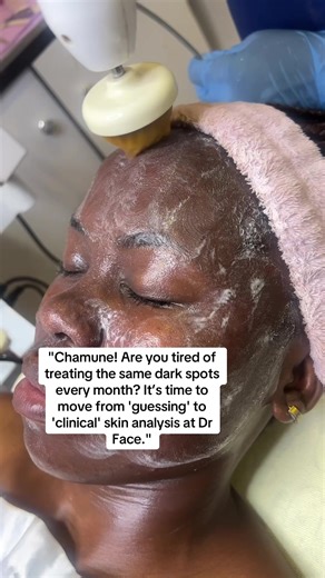 Clinical Skin Analysis for Dark Spots