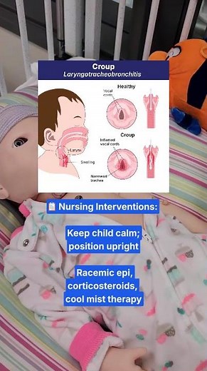 Croup Sounds Like THIS: Nursing & NCLEX Tip
