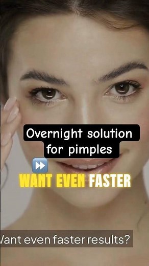 Get Rid of Pimples In 1 Day Powerful Homemade Face pack