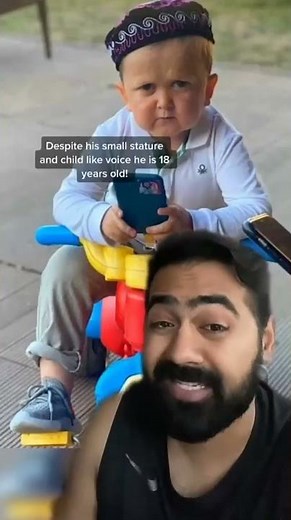 Doctor explains Hasbulla's rare genetic condition 😮