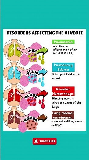 Disorders Affecting the Alveoli Explained: Pneumonia, Edema, Hemorrhage & Lung Cancer
