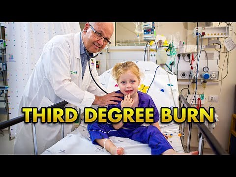 3rd Degree Burn Explained