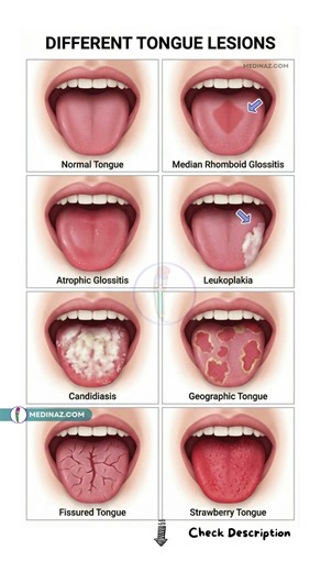 These Tongue Signs Should NEVER Be Ignored ⚠️