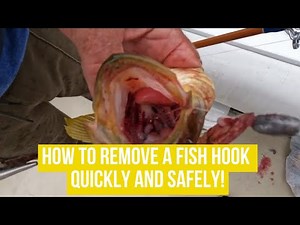 How To Remove a Fish Hook Quickly and Safely!