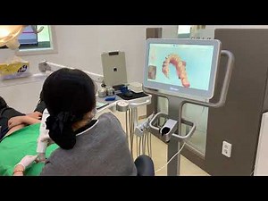 인비절라인 전용 스캐너 아이테로 3D 구강 스캔