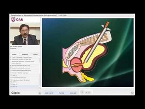 SPC complications Intraprocedural