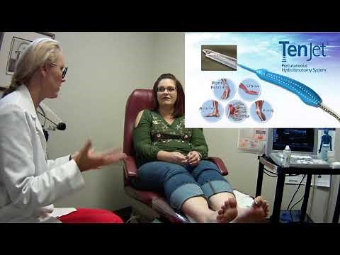 Heel Pain Patient Testimony after TenJet Procedure with Dr. Wellens