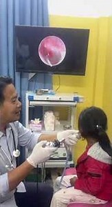 🔍✨ Endoscopic Earwax Removal — Perfect Clean! #earwax #entcheck #shorts