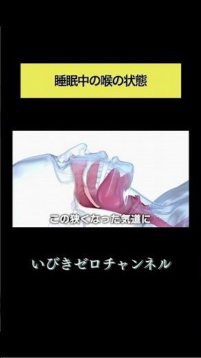 【徹底解明】いびきが起こる驚きのメカニズム #睡眠改善 #いびきレーザー治療