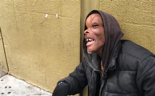 美国医学史上的奇迹，男子被霰弹枪击中头部，前脑被切除