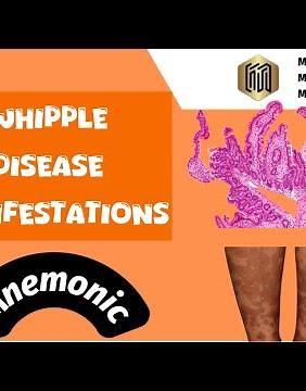 Whipple Disease Presentations: The Easy Mnemonic!