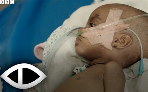 21K views · 562 reactions | “Barondera amazi ahezagiye, ngo buzuze mu nda”. Inzara n’ #ingwara, biza vyunyura ubukene bw’aba nye #Tigray, leta imwe ya #Ethiopia, bamaze imyaka ibiri bateshejwe ivyabo n’ #intambara. Uko benshi babayeho, ni muri iyi nkuru kuri #BBC #Gahuza. | BBC News Gahuza | Facebook