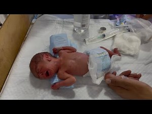 28-Week Premature Baby | Critical Condition IV Line Insertion Procedure | NICU Emergency Care
