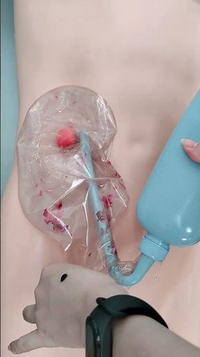 How to clean the one-piece ostomy bag