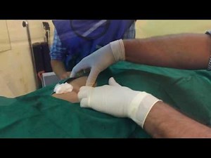 Psoas and Quadratus Lumborum muscle injection fluoro guided