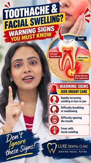 👉 Toothache & Facial Swelling? Warning Signs You Must Know | Dentist in Patna