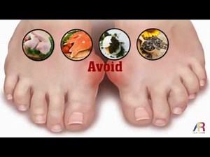 5 Foods High In Purines That Gout Patients Should Avoid