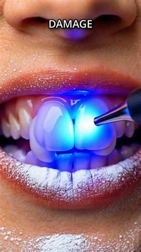 This tooth was almost gone #dentist #rescue