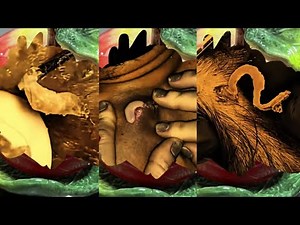 Most Satisfying Pimple Popping & Blackhead Removal Compilation | Oddly Relaxing ASMR 134