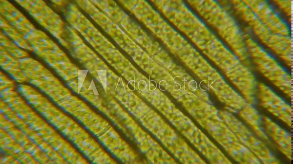 Motion Cells Chloroplast Under Microscope. Chlorophyll Cell Division. Cell Structure Leaf Plants. Leaf Photosynthesis With Chloroplasts Moving Under Microscopic View. Virus infection. GMO. DNA.