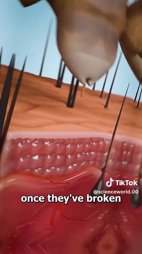 The Truth About Lice: How They Really Feed on Your Scalp