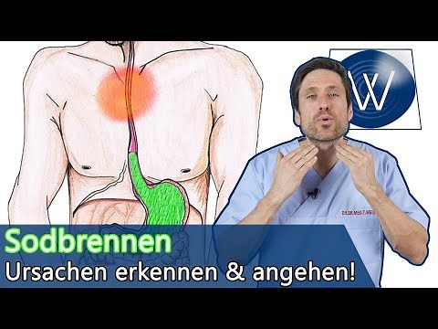 5 main causes of heartburn: What you should pay attention to if you have problems with reflux
