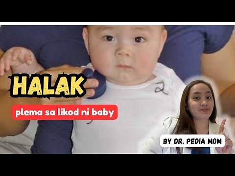 Plema sa likod ni baby — HALAK| Dahilan at Gamot by Dr. Pedia Mom