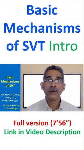 Basic Mechanisms of Supraventricular Tachycardia