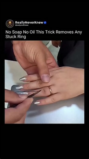 Curiosity | Knowledge | Science on Instagram: "Remove a Stuck Ring Using Just a Thread This technique works by reducing swelling and compressing the finger to safely slide a ring off. When a ring gets stuck, it’s usually due to fluid buildup or slight inflammation that increases the finger’s diameter, making removal difficult. By tightly wrapping a thread around the finger, the soft tissue is gently compressed, pushing excess fluid away from the area and temporarily reducing its size. Once compr
