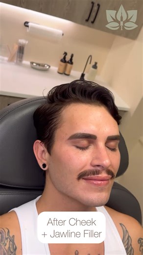 Lushful Aesthetics by InjectorChris on Instagram: "Cheek + Jawline Filler 📐 Before + After on @sethknightnyc 😏 by @injectorchris 💉 here at @lushfulaesthetics 🍃 NYC 📍 18 E 41st St. 14th Floor, New York, NY 10017 SoCal 📍 1150 Silverado St. Suite 308, La Jolla, CA 92037 💉 Medical Director: @doctorcarlton . . http://LushfulAesthetics.com #nycmicroneedling #nyclaser #nycbotox #nycfiller #nyclipfiller #educational #nycjawlinefiller #maleinjectables #nycnursepractitioner #nycmedspa #nycinjectabl