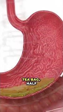 Bloating & Gas? Fix It Fast Naturally