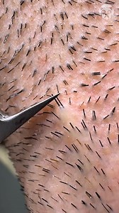 Satisfying beard plucking Partner: Cherry Chuckle | DeMilked