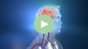 超悪玉が多いとどうなる？