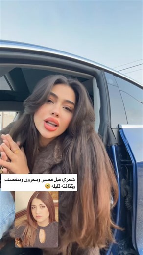 ‎جَواهِر | Jawaher‎ on Instagram‎: "البكج العلاجي 🌿الاول من نوعه في الشرق الاوسط من جواهر يعالج فروة الرأس من التساقط🌿 يعمل على إنبات الشعر 🌿وزيادة كثافة الشعر وزيادة طول الشعر خلال شهر من ٤سم ل ٦ سم يعطي نعومة ولمعان من اول استخدام الطلب من خلال رسائل الصفحة"‎