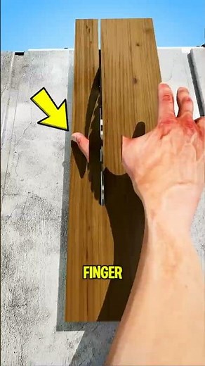 Cut Off a Finger? This One Mistake Can Ruin Everything