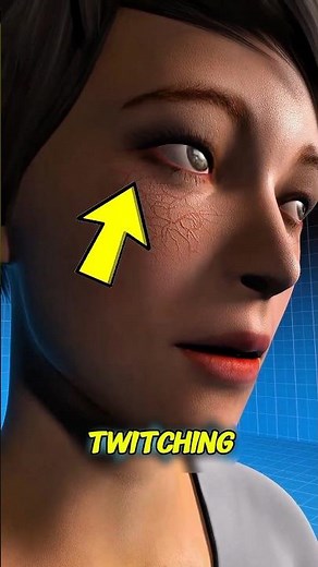 Why Your Eye Won't Stop Twitching😱