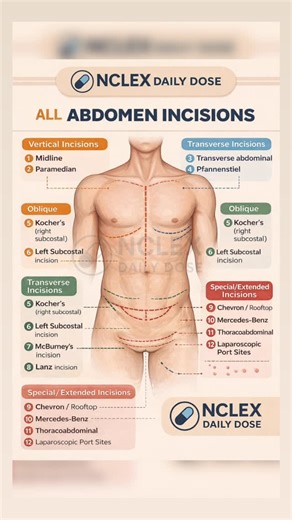 Nclex daily dose on Instagram: "✅ What is CORRECT ✔️ Midline incision – correct ✔️ Paramedian incision – correct ✔️ Pfannenstiel incision – correct ✔️ Kocher’s incision (Right subcostal) – correct ✔️ Left subcostal incision – correct ✔️ McBurney’s incision – correct ✔️ Lanz incision – correct ✔️ Chevron / Rooftop incision – correct ✔️ Mercedes-Benz incision – correct ✔️ Thoracoabdominal incision – correct ✔️ Laparoscopic port sites – correct ⸻ ❌ What is WRONG / NEEDS FIX 🔴 Kocher’s incision is 