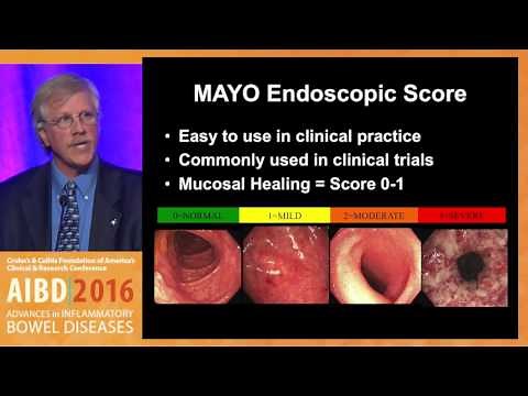 How can we best determine endoscopic severity in ulcerative colitis and Crohn's disease?