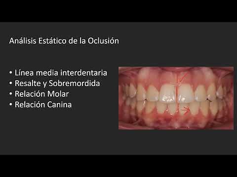 Conceptos básicos de Oclusion