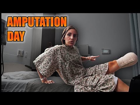 Amputation Day...goodbye foot