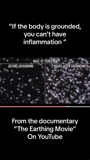 344K views · 7.5K reactions | If your body isn't grounded, you can't...