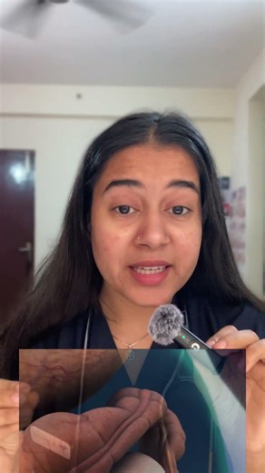 Pet me gud gud kyun hota hai? | Doctor explains #medicine #medicalawareness #stomach #doctorexplains