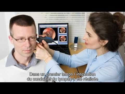 AURICAL FreeFit - Placement du Tube In Vivo