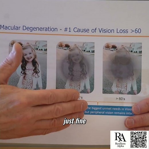 Resilient Alpha Understanding Scotoma—Central Vision Loss Explained 👁️📘 #shorts #vision