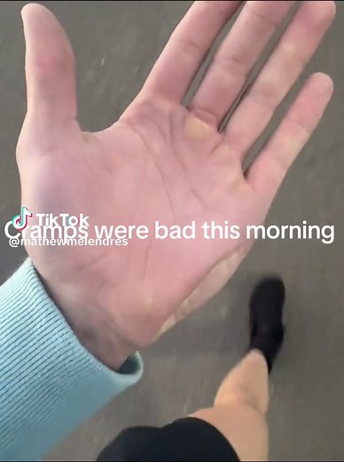 Understanding Hand Cramps: Causes and Solutions
