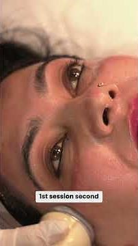 She tried everything at home until she realized pigmentation needs the right diagnosis.