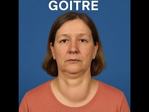 How to Differentiate Goitre (Thyroid Swelling) from a Thyroglossal Cyst: Clinical Examination