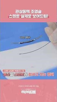 Coronary Angiography (CAG) and Stent Procedure Revealed! #CoronaryArteryDisease #ProfessorJungRaeJo