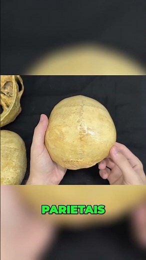 Anatomy of the Skull: Parietal Bone